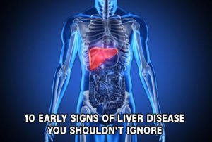 10 Early Signs of Liver Disease You Shouldn't Ignore - Mental Scoop